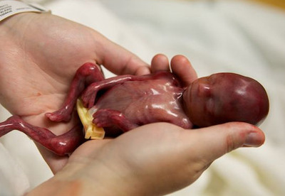 Bebé prematuro de 19 semanas, que consiguió vivir unos minutos, conmueve a millones de personas Bebé prematuro de 19 semanas, que consiguió vivir unos minutos, conmueve a millones de personas