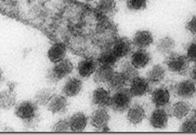 Que es un virus Que es un virus