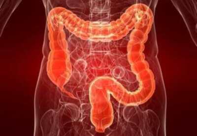 Limpiar el colon de manera natural Limpiar el colon de manera natural