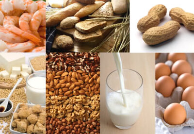 Alimentos con serotonina Alimentos con serotonina