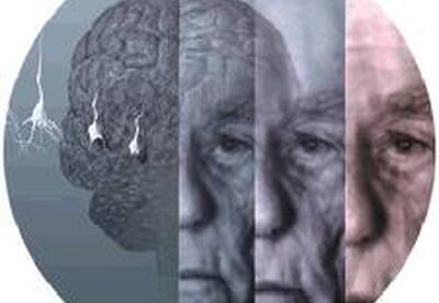 Nueva vacuna contra el alzheimer Nueva vacuna contra el alzheimer