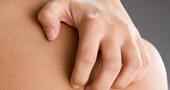 Tratamiento para la dermatitis Tratamiento para la dermatitis