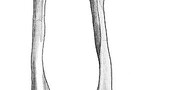 Conbriza: nuevo medicamento para el tratamiento de la osteoporosis Conbriza: nuevo medicamento para el tratamiento de la osteoporosis