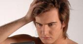 La caÃda del cabello precoz reduce riesgos de cáncer de próstata La caÃda del cabello precoz reduce riesgos de cáncer de próstata