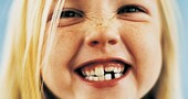 Alimentos para los dientes de los niños