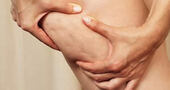 La celulitis y cómo combatirla La celulitis y cómo combatirla