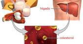 Sintomas de trigliceridos altos Sintomas de trigliceridos altos