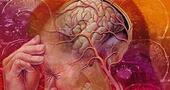 Migrañas tratamiento Migrañas tratamiento