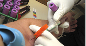 Analisis Beta HGC en sangre | Test de Embarazo Analisis Beta HGC en sangre | Test de Embarazo