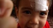 Cómo curar una herida a los niños Cómo curar una herida a los niños