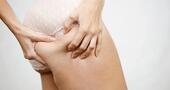 Combatir la celulitis naturalmente Combatir la celulitis naturalmente