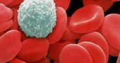 Globulos blancos y rojos| videos Globulos blancos y rojos| videos