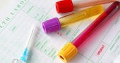 Pruebas fertilidad | Analisis sangre, orina Pruebas fertilidad | Analisis sangre, orina