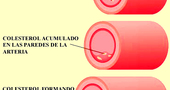 Consejos a tener en cuenta sobre el colesterol Consejos a tener en cuenta sobre el colesterol