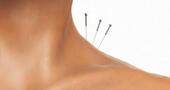 Acupuntura para reducir el dolor menstrual Acupuntura para reducir el dolor menstrual