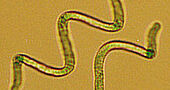 Composición de la espirulina Composición de la espirulina