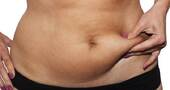 Barriga despues del embarazo Barriga despues del embarazo