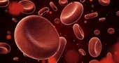 Cómo subir la Hemoglobina baja Cómo subir la Hemoglobina baja