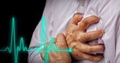 Consejos para prevenir infartos (Parte 2) Consejos para prevenir infartos (Parte 2)