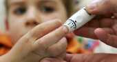 Diabetes mellitus tipo 2 en niños Diabetes mellitus tipo 2 en niños