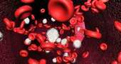 La anemia y el hierro
