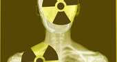 Las radiaciones médicas, en perspectiva Las radiaciones médicas, en perspectiva