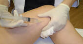 Mesoterapia,para combatir la celulitis Mesoterapia,para combatir la celulitis