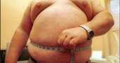 Que es la obesidad mórbida Que es la obesidad mórbida