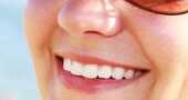 Remedios caseros para dientes amarillos Remedios caseros para dientes amarillos