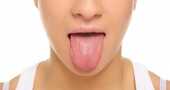 Remedios para ampollas en la lengua