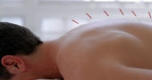 Ventajas y desventajas de la acupuntura Ventajas y desventajas de la acupuntura