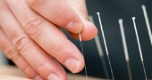 Ventajas y desventajas de la acupuntura