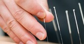 Ventajas y desventajas de la acupuntura Ventajas y desventajas de la acupuntura