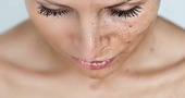 Consejos para aclarar la piel del rostro