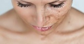 Consejos para aclarar la piel del rostro Consejos para aclarar la piel del rostro