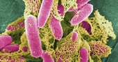 E coli bacteria| epidemia
