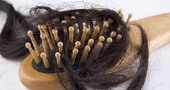 Vitaminas para la caída del cabello Vitaminas para la caída del cabello