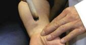 Para qué sirve la moxibustión Para qué sirve la moxibustión