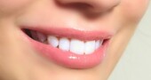 Cuida de tus dientes sensibles Cuida de tus dientes sensibles