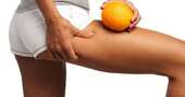 12 Consejos para eliminar la celulitis 12 Consejos para eliminar la celulitis