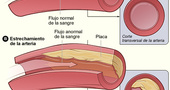 Novedoso estudio para medir la edad real de las arterias Novedoso estudio para medir la edad real de las arterias