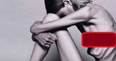 Bulimia y Anorexia: Un mal que nos afecta a todos Bulimia y Anorexia: Un mal que nos afecta a todos