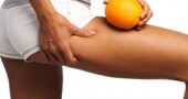 Ejercicio contra la celulitis Ejercicio contra la celulitis