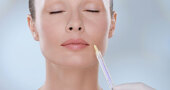 Botox vs. Emervel, el nuevo relleno de ácido hialurónico de laboratorios Galderma