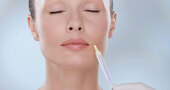 Botox vs. Emervel, el nuevo relleno de ácido hialurónico de laboratorios Galderma Botox vs. Emervel, el nuevo relleno de ácido hialurónico de laboratorios Galderma
