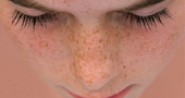 ¿Cómo librarse de las pecas del rostro? ¿Cómo librarse de las pecas del rostro?