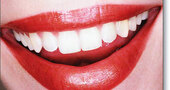 Carillas Lumineers y Snap-On Smile, los últimos tratamientos para lucir una sonrisa de celebrity